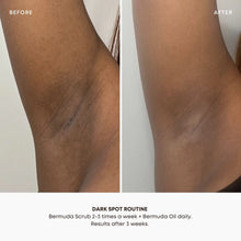 Load image into Gallery viewer, Dark Spot Oil