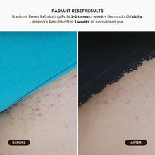 Load image into Gallery viewer, Radiant Reset Exfoliating Toner Pads
